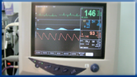 Campbell Village Veterinary Clinic regularly uses Electrocardiography to monitor patients under anesthesia.
