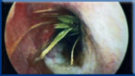 Campbell Village Veterinary Clinic uses Endoscopy as an aid to diagnose problems not easily seen.
