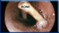 Campbell Village Veterinary Clinic uses Endoscopy as an aid to diagnose problems not easily seen.